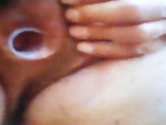 Didi mit rohr 15mm un der Urethra bis un die Blase